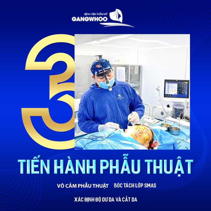 Căng Da Mặt Toàn Phần - Bí Quyết Trẻ Hóa Không Để Lại Sẹo 9 QUY TRINH CANG DA