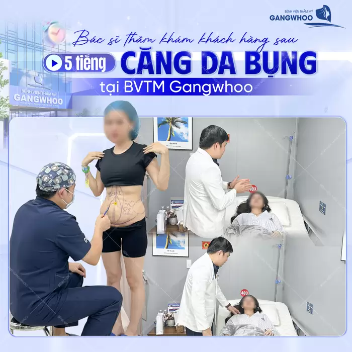 Căng Da Bụng Là Gì? Trường Hợp Nào Nên Và Không Nên Thực Hiện 13 bs tham kham khach hang sau 5 tieng cang da bung