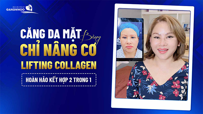 cang da mat bang chi nang co lifting collagen