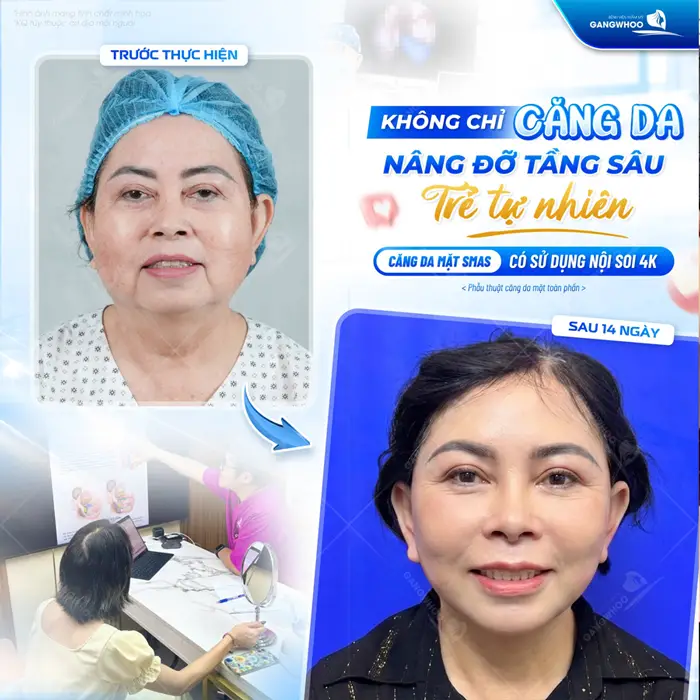 Trẻ hóa diện mạo nhan sắc thêm thăng hạng nâng đỡ tầng sâu sau 14 ngày nhan sắc trẻ, diện mạo thêm tươi tắn