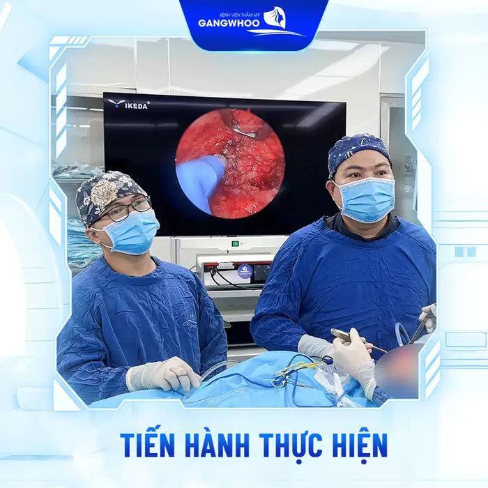 Phẫu Thuật Căng Da Trán Nội Soi 4K - Thổi Bay Nếp Nhăn Trán
