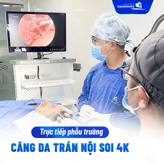 Phẫu Thuật Căng Da Trán Nội Soi 4K - Thổi Bay Nếp Nhăn Trán
