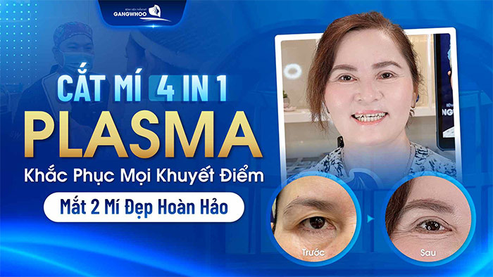 cat mi 4 in 1 plasma 1