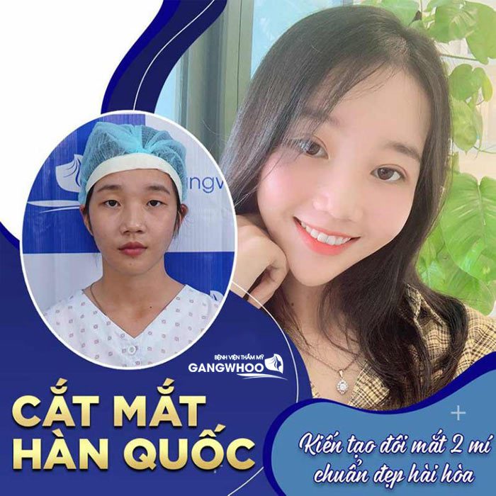 cat mi han quoc 1