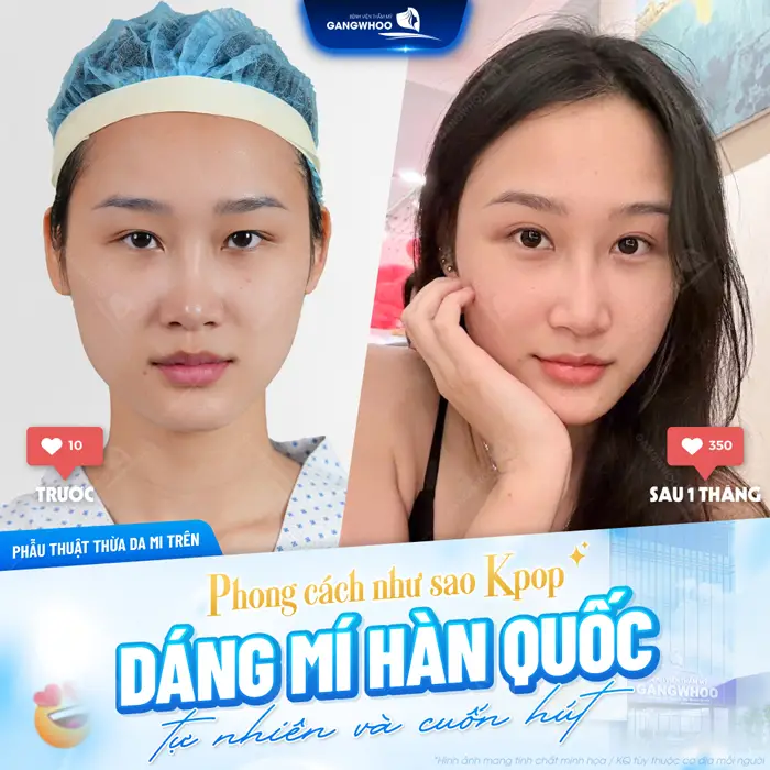 Phong cách đẹp như sao Kpop dáng mí Hàn Quốc đẹp tự nhiên và siêu cuốn hút