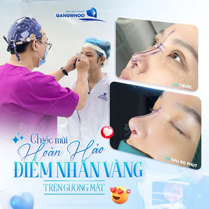 Chiếc mũi hoàn hảo điểm nhấn cho diện mạo khuôn mặt thêm sắc nét và cuốn hút