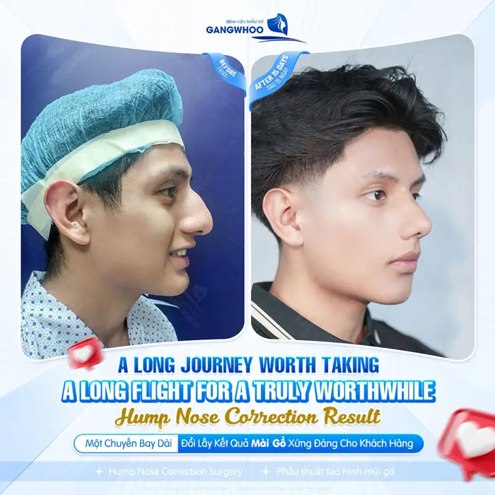 Một chuyến đi dài đổi lấy kết quả mài gồ xứng đáng cho khách hàng 
