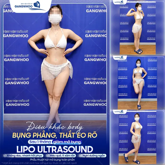 Điêu khắc body bụng phẳng, tự tin khoe thắt eo đẹp rõ chỉ 1 tháng giảm mỡ bụng đã tự tin rạng rỡ trở lại