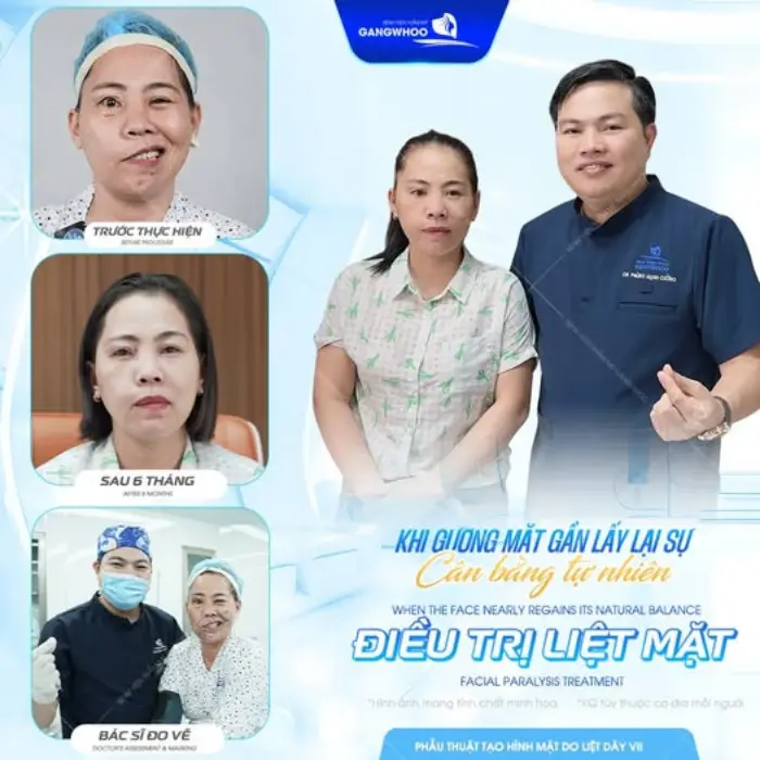 Điều trị liệt dây thần kinh số 7; gương mặt cân xứng, cải thiện chức năng co bóp cơ mặt