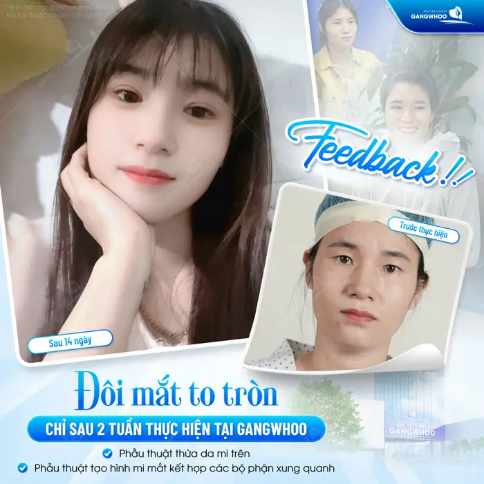 doi mat thay doi ro ret chi sau 2 tuan thuc hien