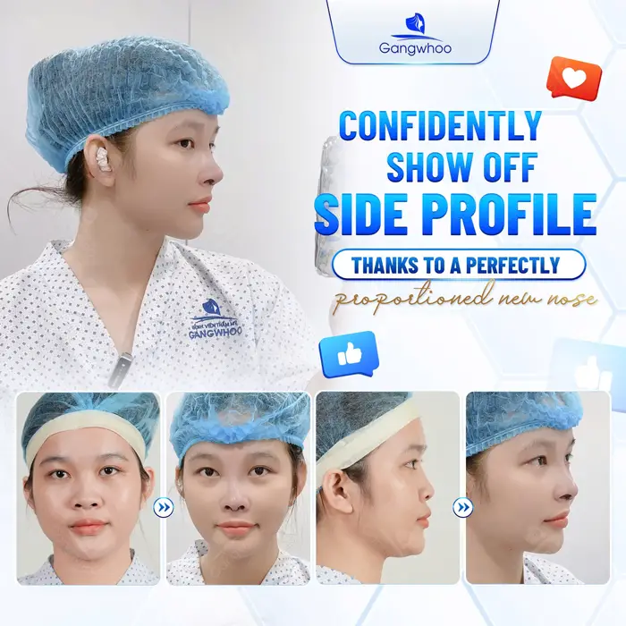 en nang mui perfect 3