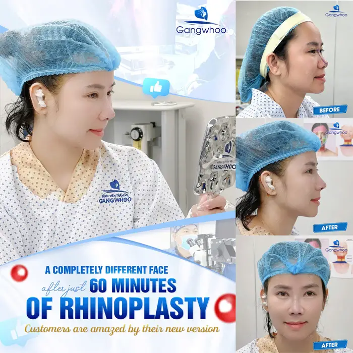 en nang mui perfect 4