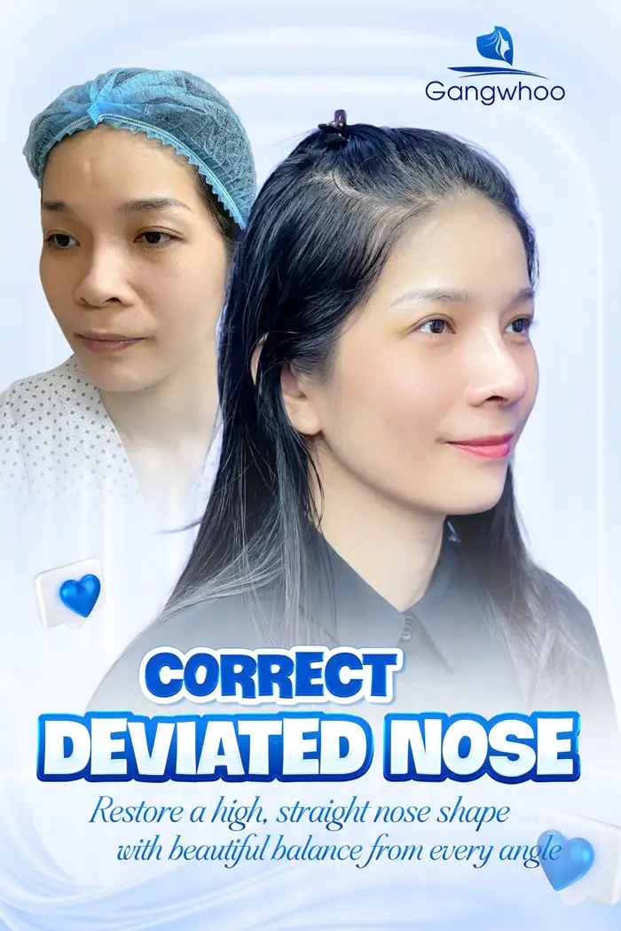 en nang mui perfect 5