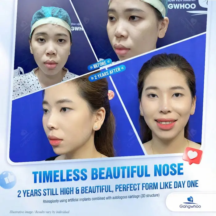 en nang mui perfect 6