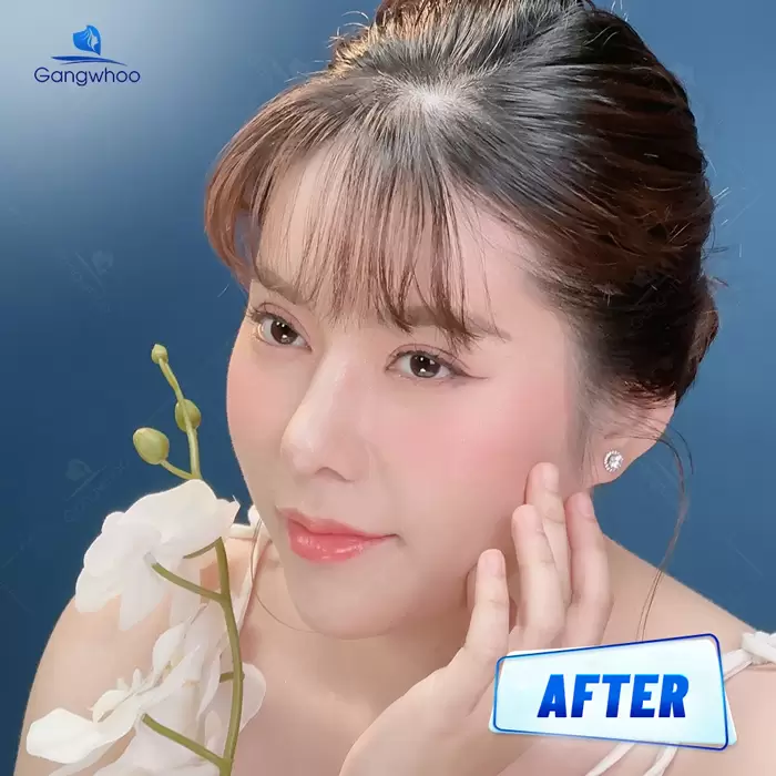 en nang mui sun suon 3