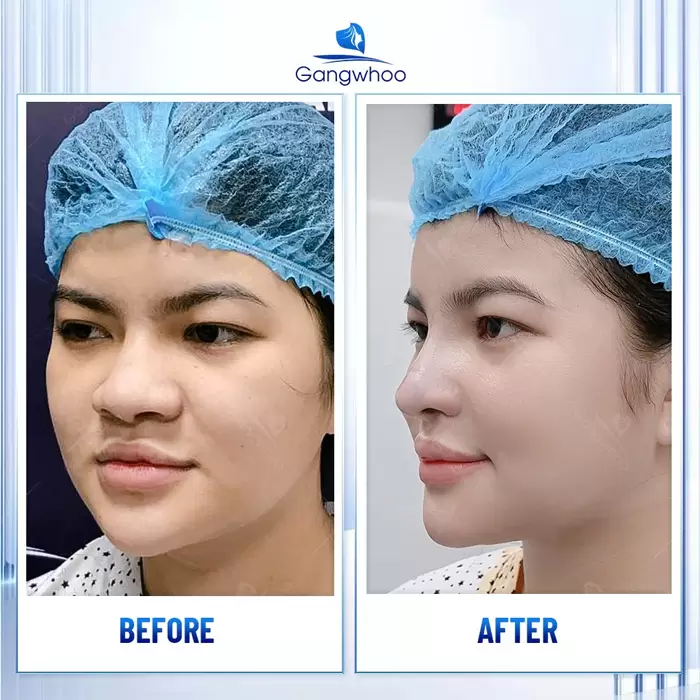 en thu nho dau mui 3