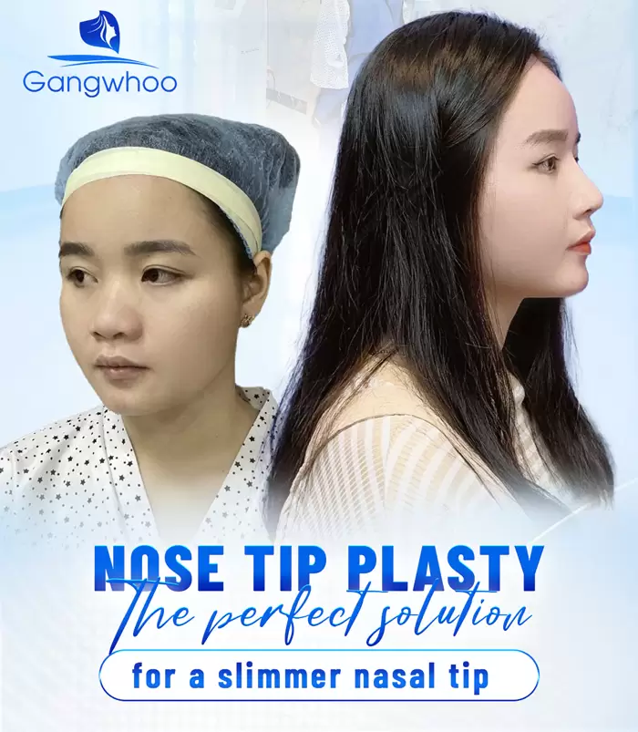 en thu nho dau mui 4