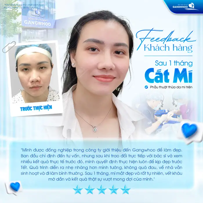 fb khach hang sau 1 thang cat mi mat cai thien sac dien cho tong the khuon mat them nuot na can doi va toa sang