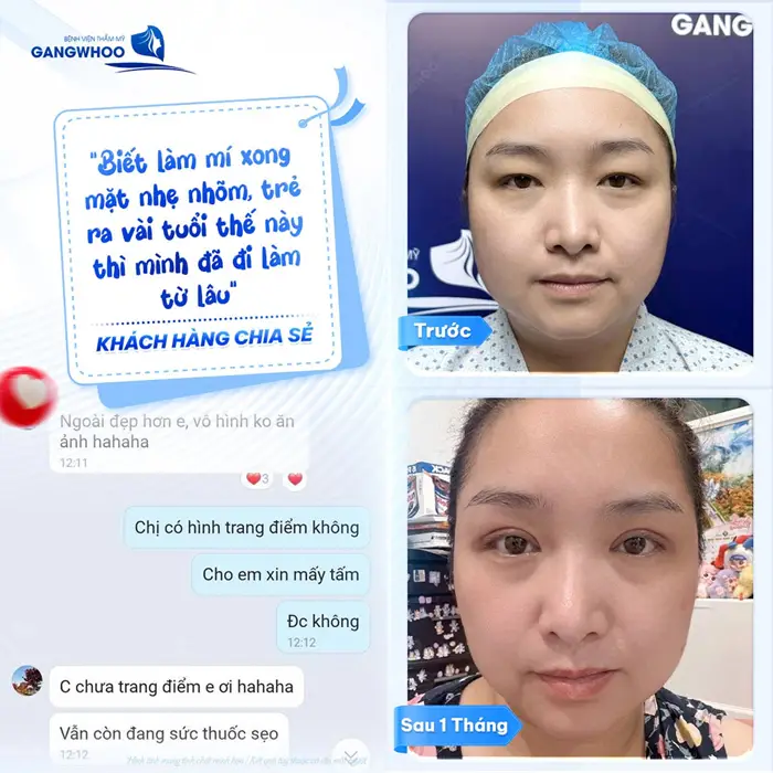 fb mat dep sau 1 thang thuc hien chi khach chia se hinh anh thuc te