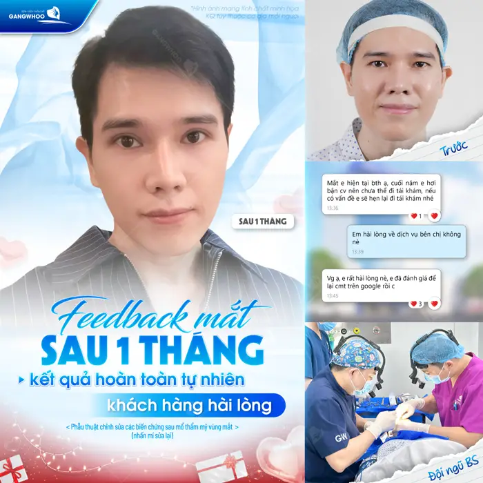 fb sau 1 thang thuc hien cat mi kh hai long ve dien mao