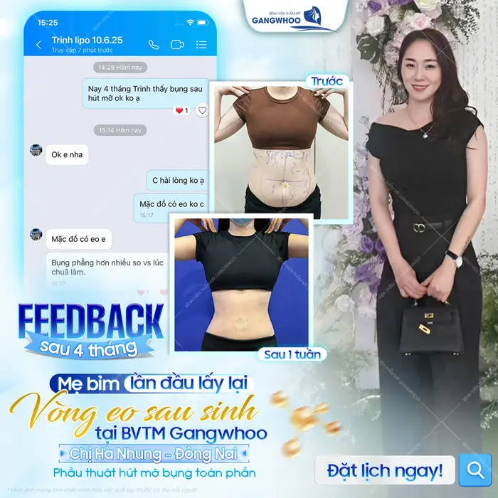 fb sau 4 thang mem bim lan day lay lai vong eo sau sinh tai bvtm gangwhoo