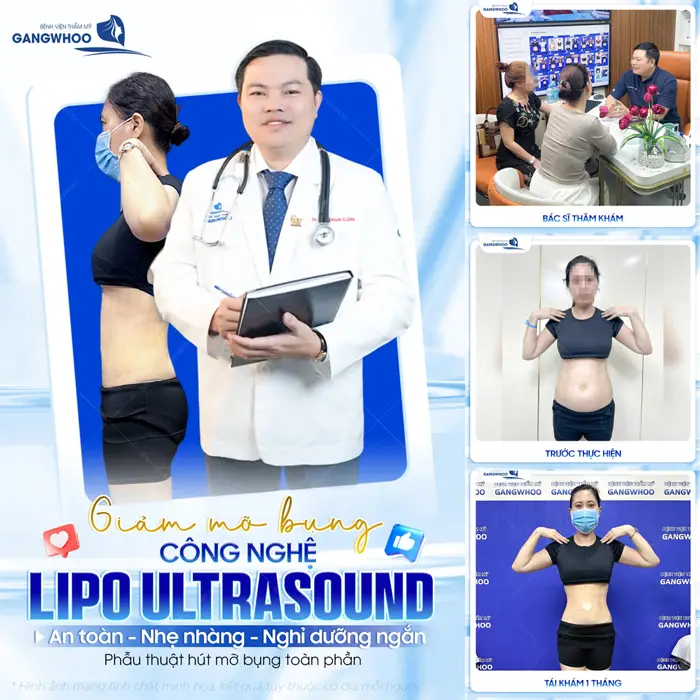 Giảm mỡ bụng công nghệ Lipo Ultrasound an toàn, nhẹ nhàng và nghỉ dưỡng ngắn