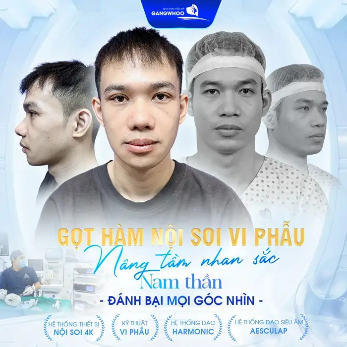 Gọt Hàm Có Đau Không? Gọt Hàm Có Ảnh Hưởng Về Sau Không? 20 Khách hàng hài lòng với kết quả gọt hàm nội soi vi phẫu của BVTM Gangwhoo