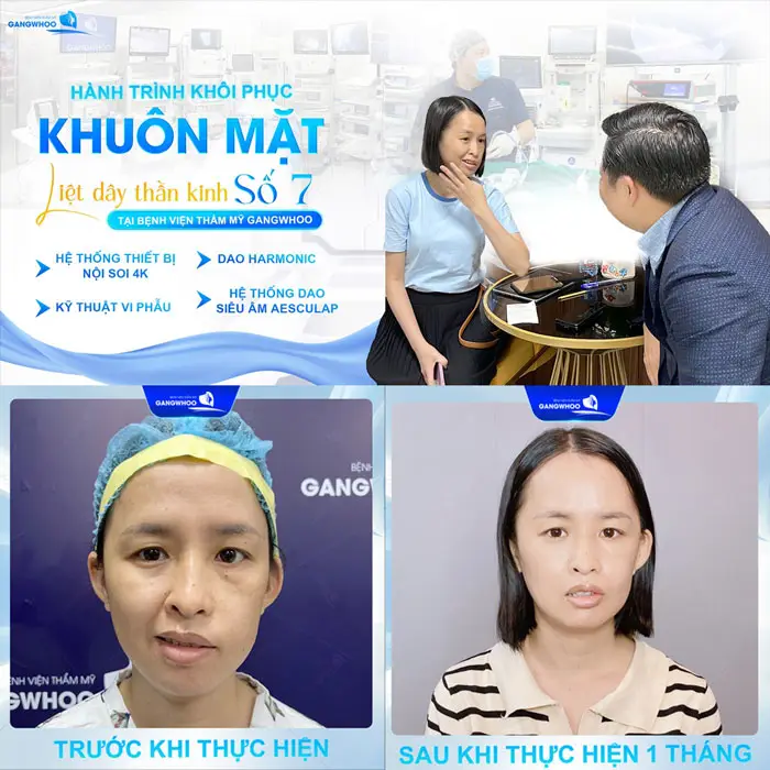 hanh trinh liet day than kinh so 7 cong nghe cao