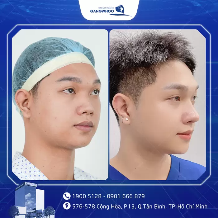 hinh anh mui dep 15