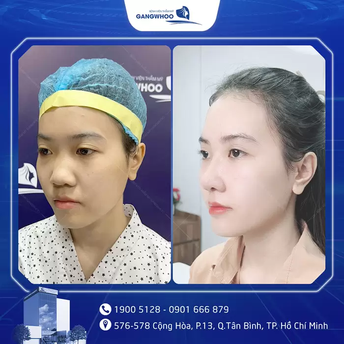 hinh anh mui dep 26