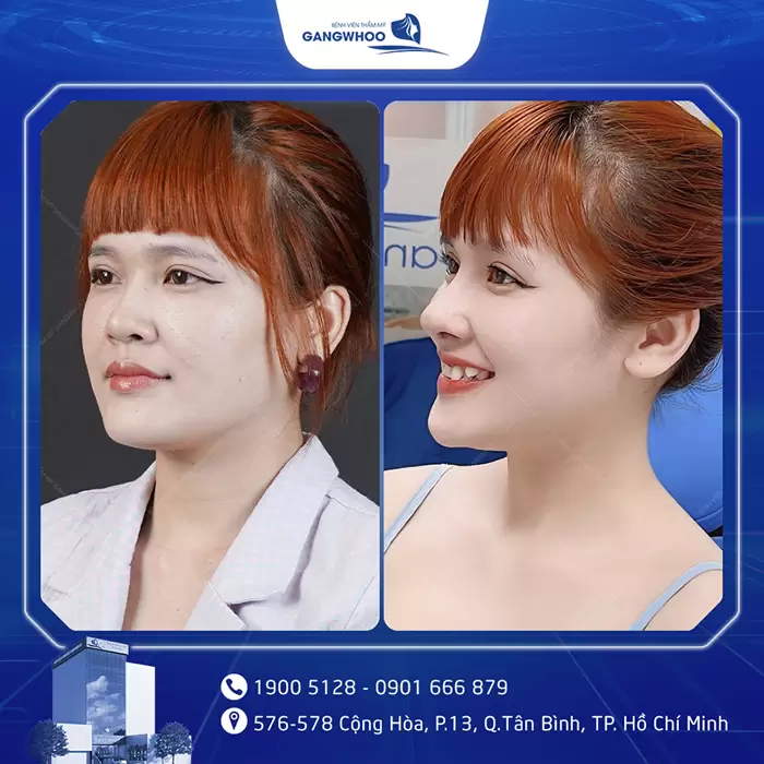 hinh anh mui dep 27