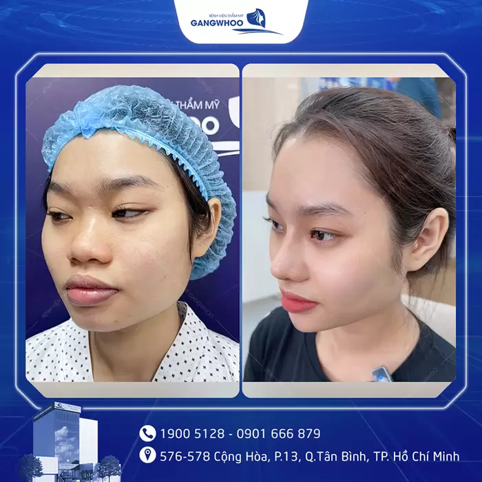 hinh anh mui dep 28
