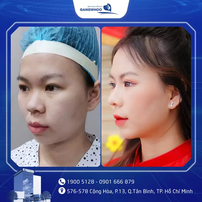 hinh anh mui dep 32