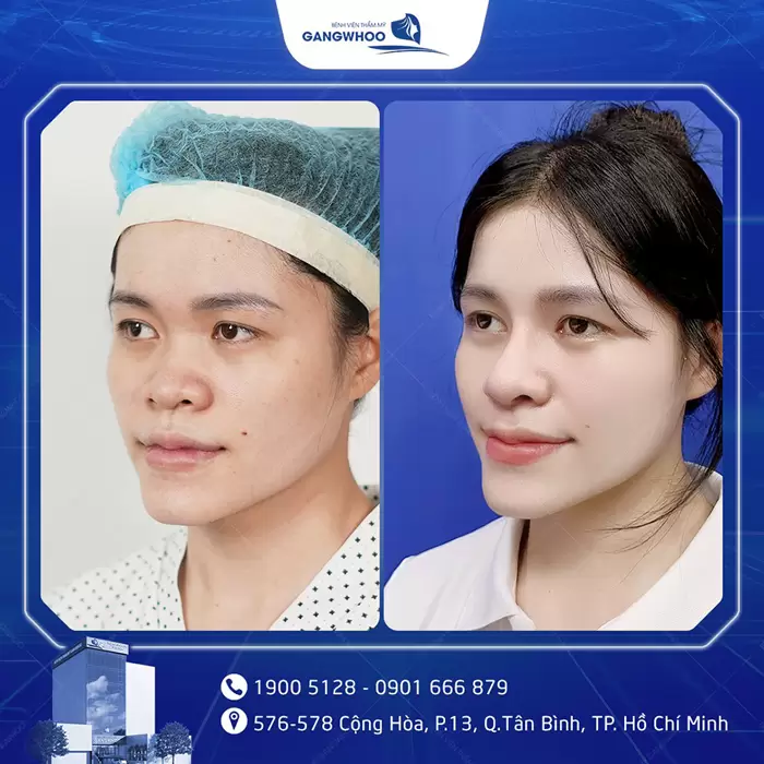 hinh anh mui dep 6