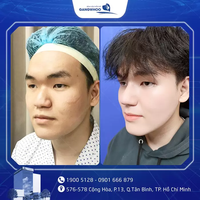 hinh anh mui dep 8