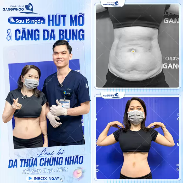 hut mo cang da bung loai bo da thua nhao chung hieu qua