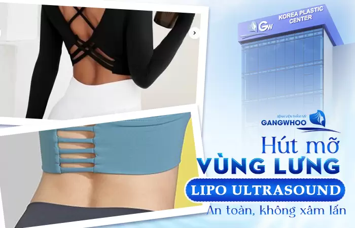 Phẫu Thuật Hút Mỡ Vùng Lưng (Lipo Ultrasound) 100% Khách Hàng Hài Lòng 5 Hút Mỡ Vùng Lưng (Lipo Ultrasound) 100% Khách Hàng Hài Lòng