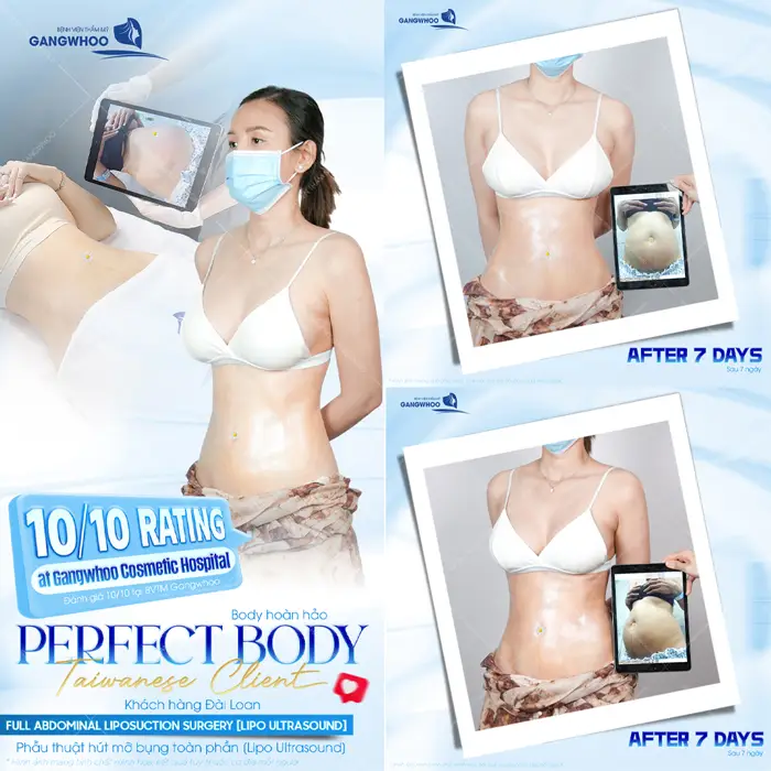 Body đẹp sang sắc vóc đẹp 10/10 chỉ sau 7 ngày tái khám ai cũng mơ ước vì quá xuất sắc