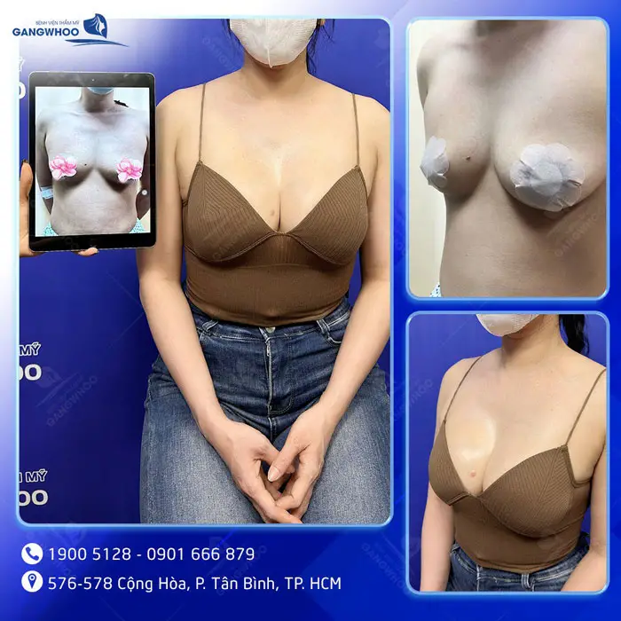 khach hang nang nguc 7