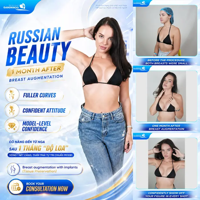 Khách Nga tự tin Pose dáng xinh đẹp và đầy cuốn hút sau nâng cấp vòng 1 tại BVTM Gangwhoo