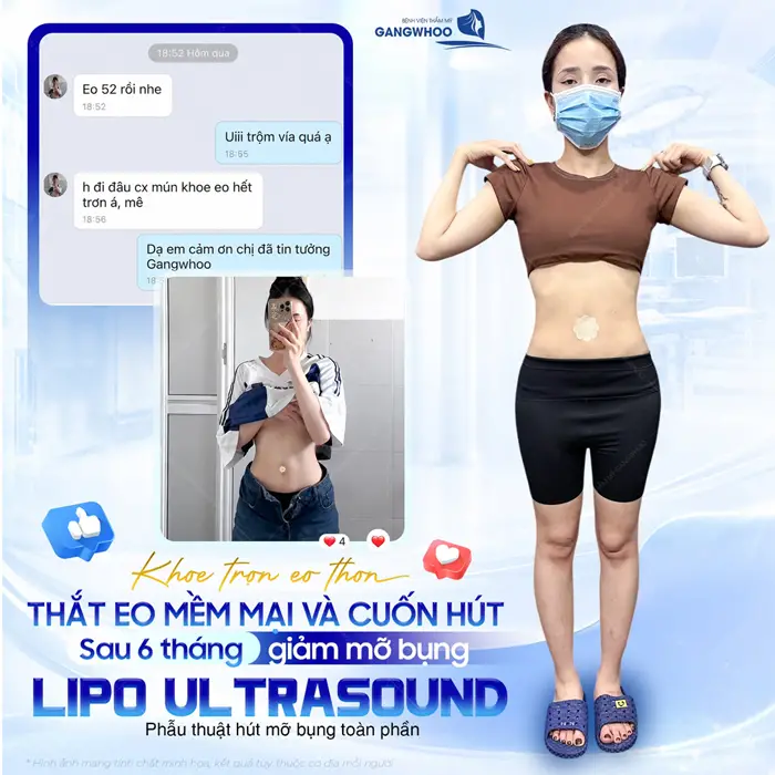 khoe tron eo thon that eo mem mai sau 6 thang giam mo bung