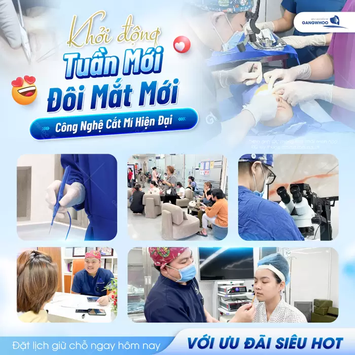 Cắt Mí Hàn Quốc Cho Bạn Đôi Mắt 2 Mí Đẹp Chuẩn "Sao Hàn" 10 Cắt mí công nghệ hiện đại tại BVTM Gangwhoo an toàn, hiệu quả và cải thiện nhanh chóng