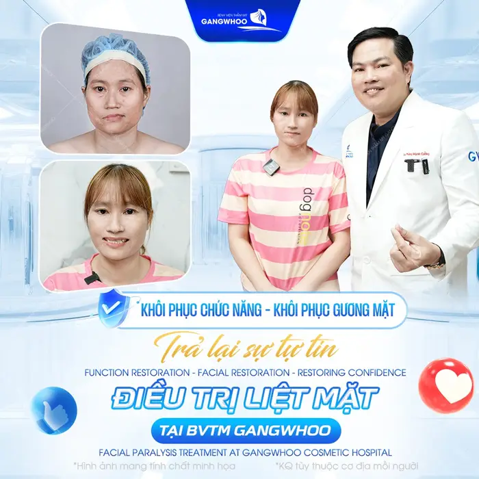 Điều Trị Liệt Mặt Nội Soi 4K - Lấy Lại Nụ Cười Trên Gương Mặt 2 Khôi phục chúc năng khôi phục gương mặt sau điều tị liẹt mặt tại bệnh viện thẩm mỹ Gangwhoo