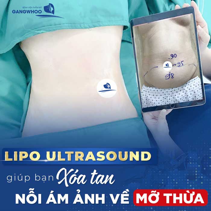 lip ultrasound 2