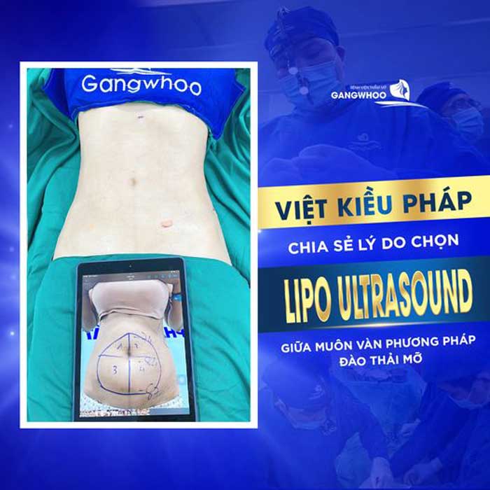 lipo ultrasound 6 1