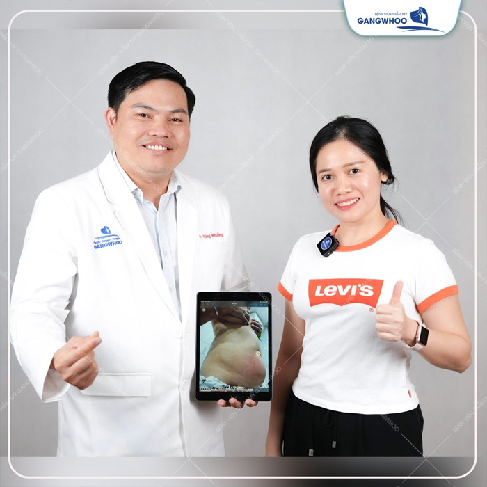 lipo ultrasound2