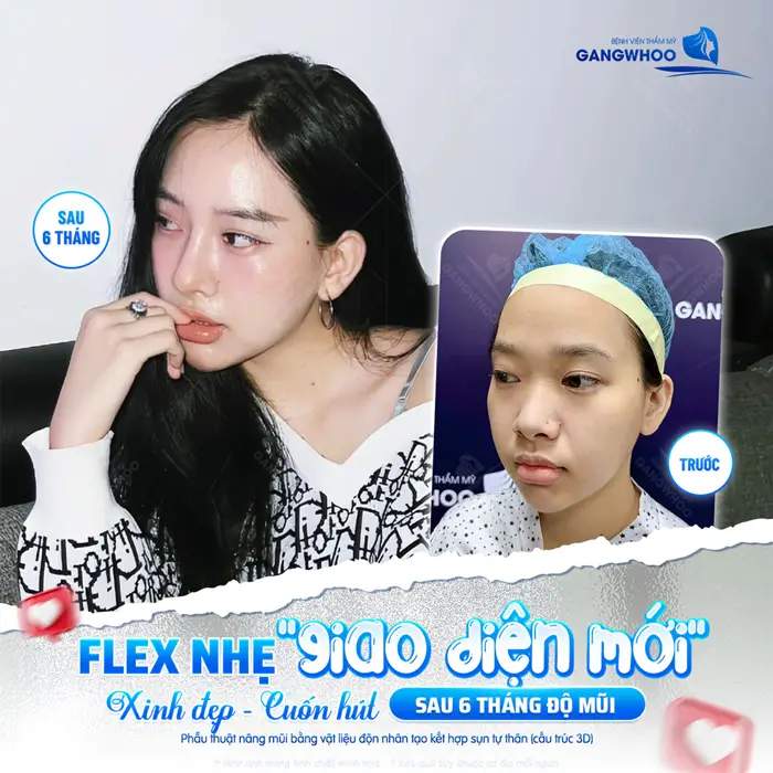 Giao diện mới, nhan sắc mới xinh đẹp và cuốn hút hơn sau 6 tháng độ mũi