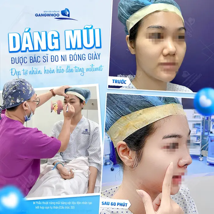 Tiến hành đo vẽ trước khi nâng mũi Hàn Quốc