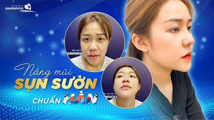 nang mui sun suon 1