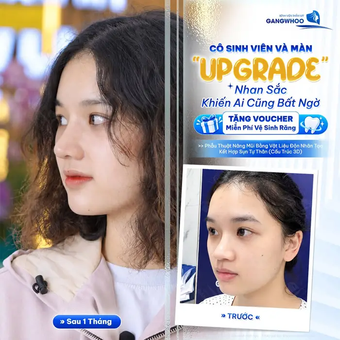 Nhan sắc thăng hạng diện mạo đầy cuốn hút sau 1 tháng thực hiện đường nét gương mặt thêm hài hòa và thanh thoát